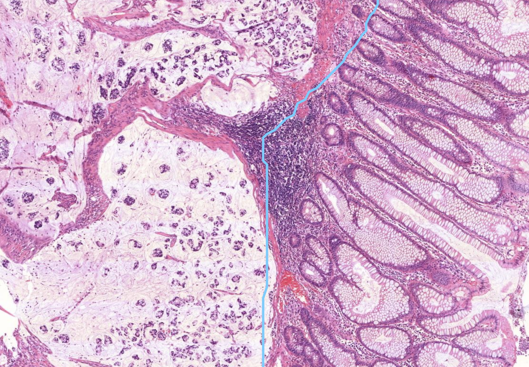 Histopathologisches Bild: Kolonschleimhaut